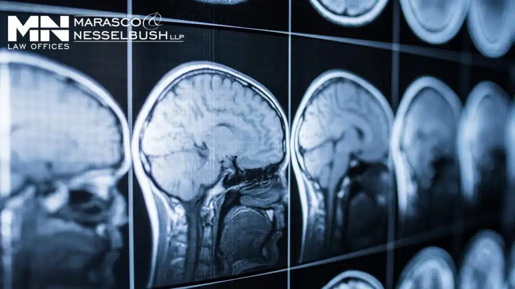 An article featuring traumatic brain injury information.