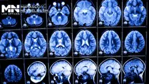 A medical image showing the internal structure of the brain using X-ray technology