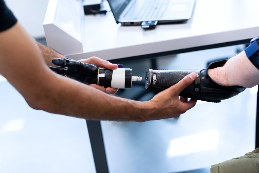 fixing an artificial arm