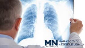 A doctor holding up an x-ray of lungs