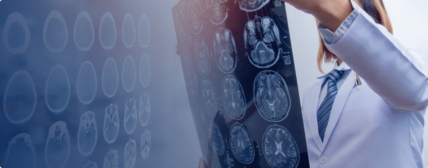 a doctor looking at an image of a brain