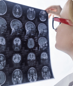 a person looking at an x-ray of a brain