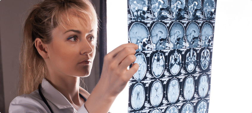 a doctor looking at the image of a brain