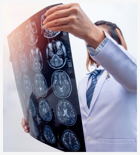 a doctor examining an x-ray of a brain