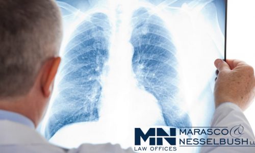 A doctor holding up an x-ray of lungs