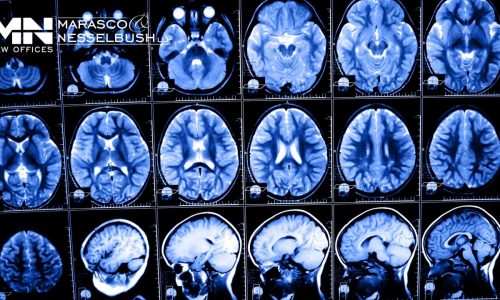 An article featuring traumatic brain injury information.