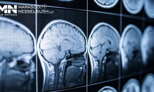 An article featuring traumatic brain injury information.